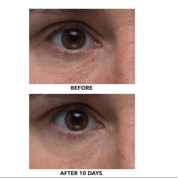 ALGENIST TRIPLE ALGAE EYE RENEWAL BALM - Picture 6 of 12